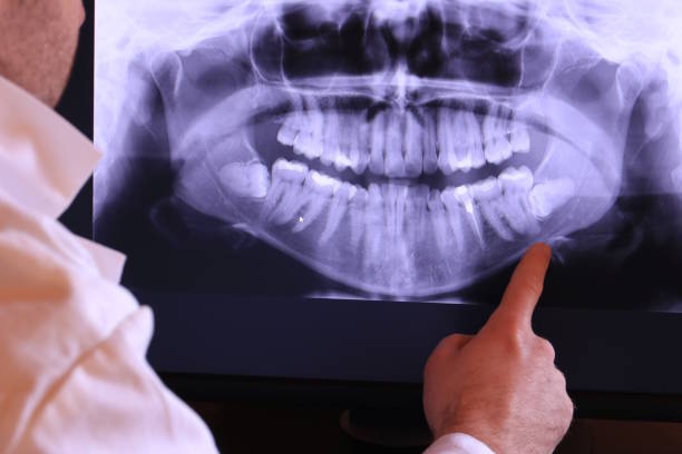 Best Weekend Emergency Dentist in Elkhorn, CA