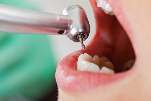 Best Emergency Denture Repair in Elkhorn, CA